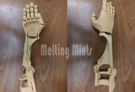 Hand