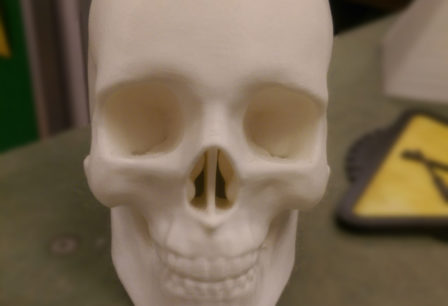 Skull
